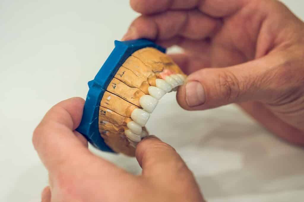 Dentures 3 Dentist Measuring New Dentures For Patient