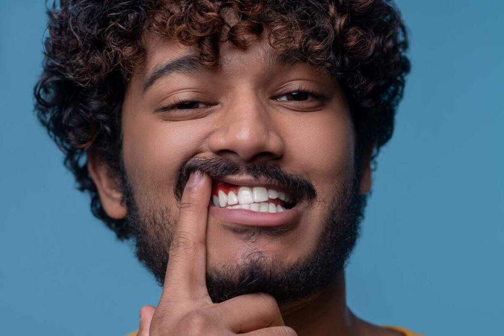 Non-Surgical Gum Therapy 1 Person Showing Gingivitis