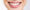 Girl With Lip Gloss And Straight Teeth Smiling