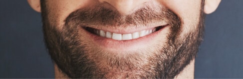 Home 6 Man With Beard And Straight Teeth Smiling