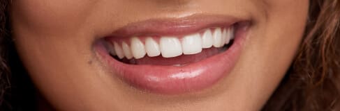 Home 7 Close Up Of Girl With White And Straight Teeth Smiling
