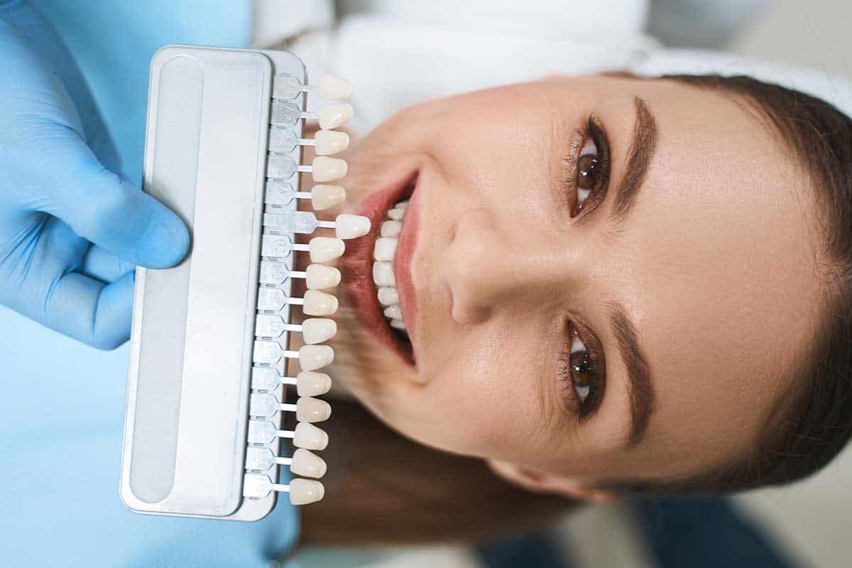Porcelain Veneers In South Edmonton Heritage Dental Centre