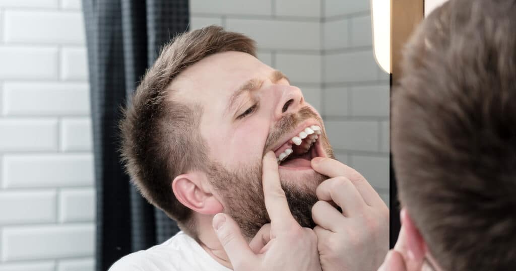 Man looks in mirror, opened mouth and examines absence of a tooth that the dentist recently removed.