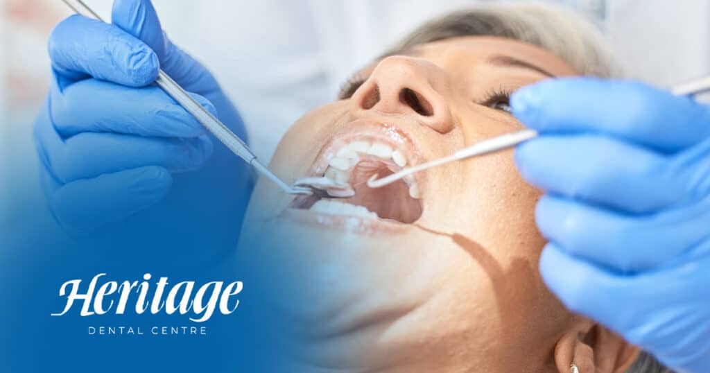 High-quality dental exam at Heritage Dental Centre Edmonton. Skilled dentist performs thorough cleaning and assessment.